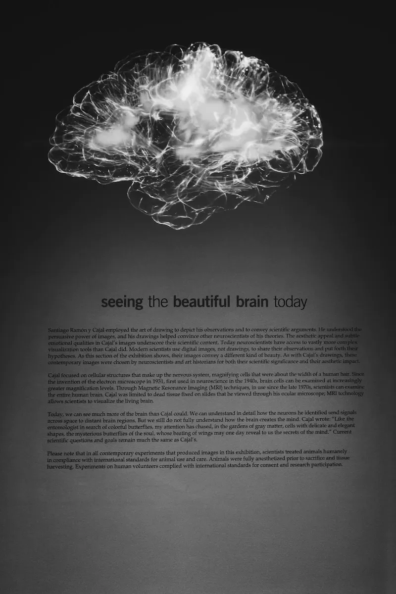 Explore the ethical implications of brain decoding technology and its impact on privacy and freedom. Learn about the challenges of cognitive transparency and the importance of protecting our mental privacy.